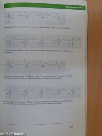 EKG-Information