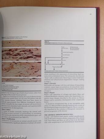 Atherosclerosis