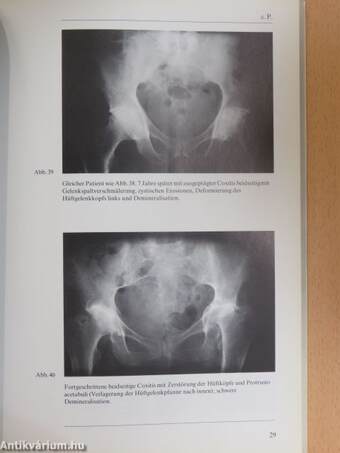 Kennbilder der wichtigsten rheumatischen Erkrankungen für die Diagnostik in der Praxis