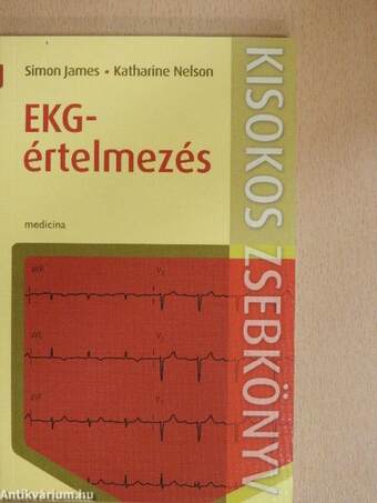 EKG-értelmezés