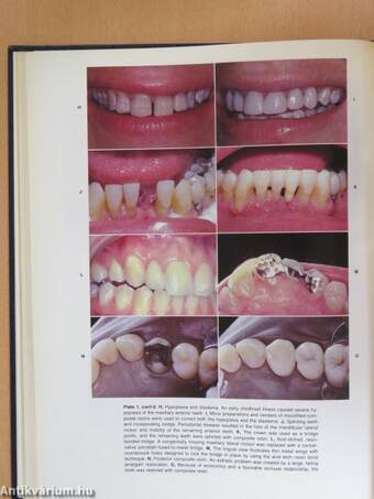 The Art and Science of Operative Dentistry