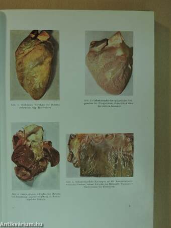 Atlas Der Pathologischen Anatomie