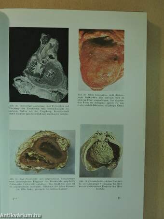 Atlas Der Pathologischen Anatomie