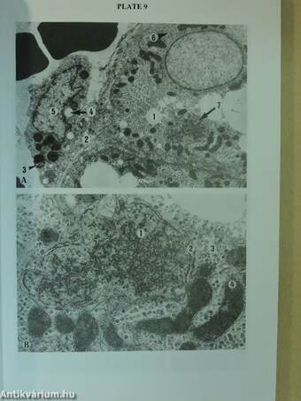 Atlas For Self-Assessment And Practice In Ultrastructural Pathology And Diagnostic Electron Microscopy