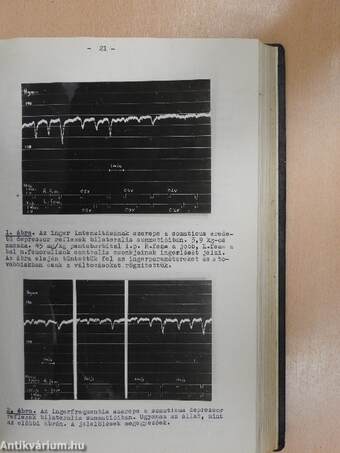 A vasomotor reflex-mechanizmusok központi idegrendszeri organisatiójának néhány kérdése