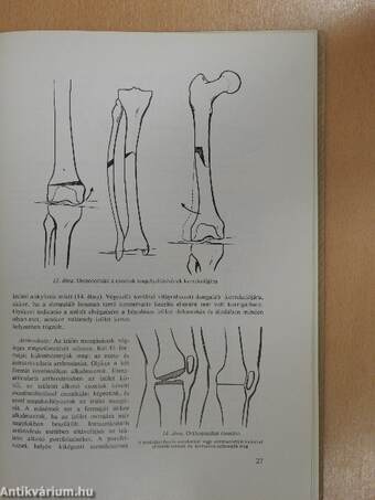 Az orthopaedia tankönyve