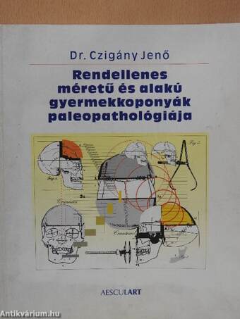 Rendellenes méretű és alakú gyermekkoponyák paleopathológiája (dedikált példány)