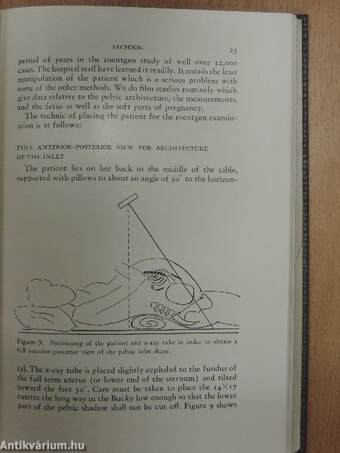 Roentgenology in Obstetrics and Gynecology