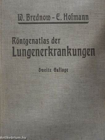 Röntgenatlas der Lungenerkrankungen