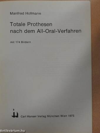 Totale Prothesen nach dem All-Oral-Verfahren