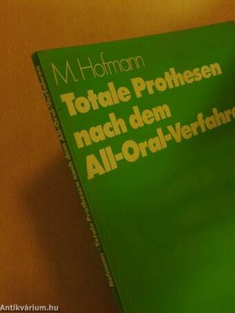 Totale Prothesen nach dem All-Oral-Verfahren