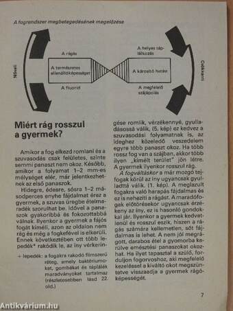 Ép fogakkal könnyen nevetsz II. 