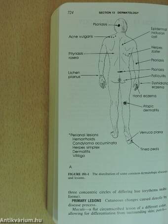 Harrison's Principles of Internal Medicine