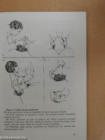 Cardiopulmonary Cerebral Resuscitation