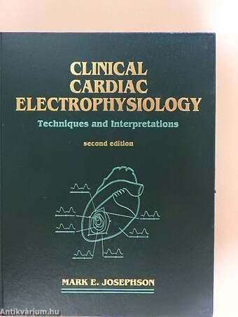 Clinical Cardiac Electrophysiology: Techniques and Interpretations