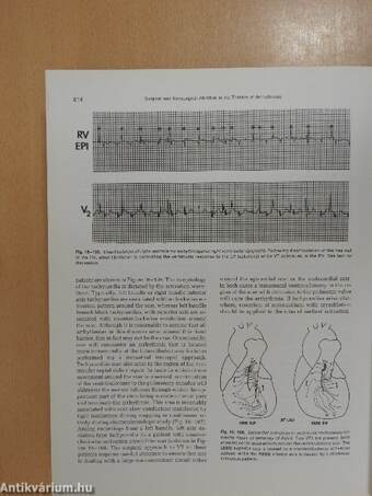 Clinical Cardiac Electrophysiology: Techniques and Interpretations