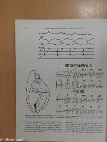 Clinical Cardiac Electrophysiology: Techniques and Interpretations