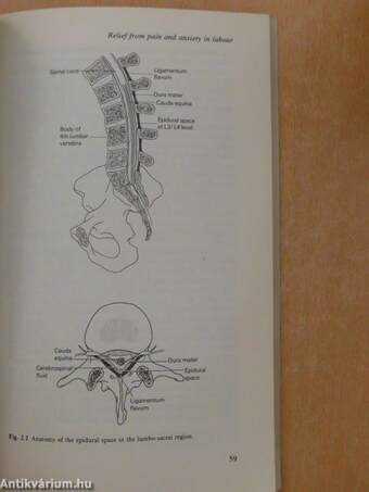 Obstetric Analgesia and Anaesthesia