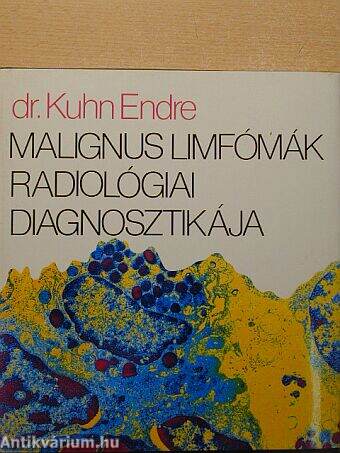 Malignus limfómák radiológiai diagnosztikája