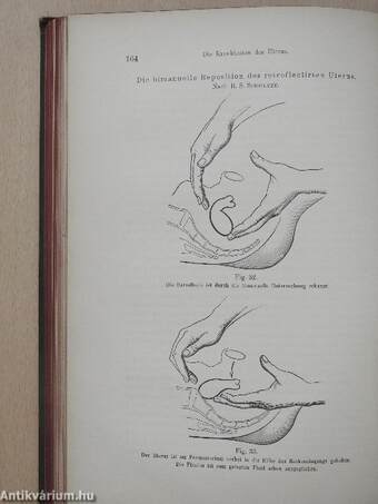 Lehrbuch der Gynäkologie