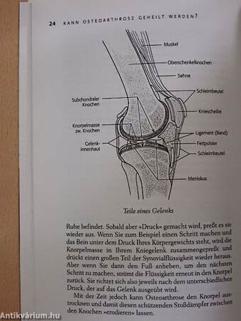 Die Arthrose Kur