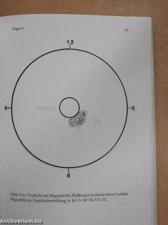 Irisdiagnose Leichtgemacht