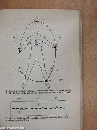 Electrocardiographia az orvosi gyakorlatban