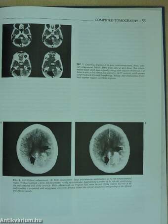 Basic Concepts in Diagnostic Imaging