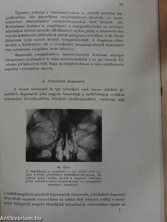 Szemészeti röntgendiagnostica