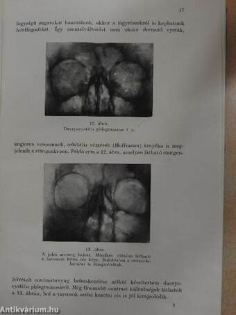 Szemészeti röntgendiagnostica