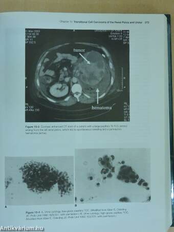 Urologic Oncology