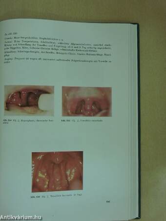 Atlas der Ohren-, Nasen- und Halskrankheiten sowie deren Grenzgebiete