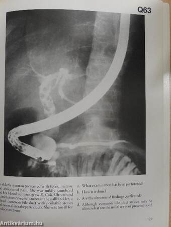 Gastro-Intestinal Radiology