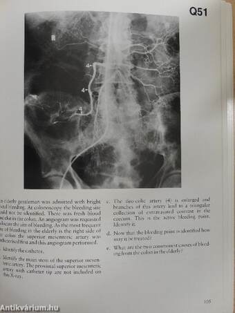 Gastro-Intestinal Radiology