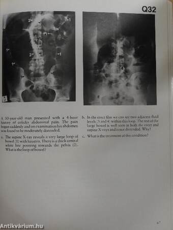 Gastro-Intestinal Radiology