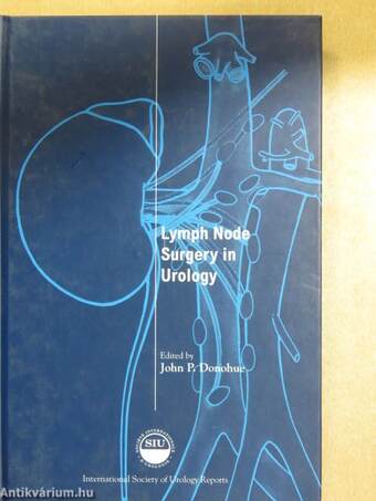 Lymph Node Surgery in Urology