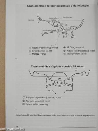 A nyaki gerinc képalkotó diagnosztikája