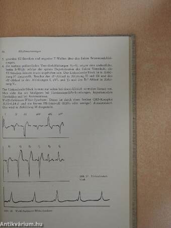 Elektrokardiographie für den Anästhesisten