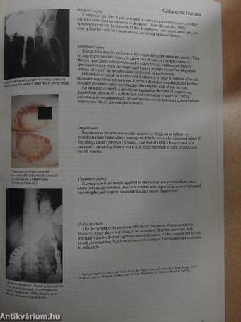 ABC of Colorectal Diseases