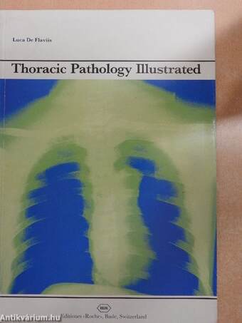 Thoracic Pathology Illustrated