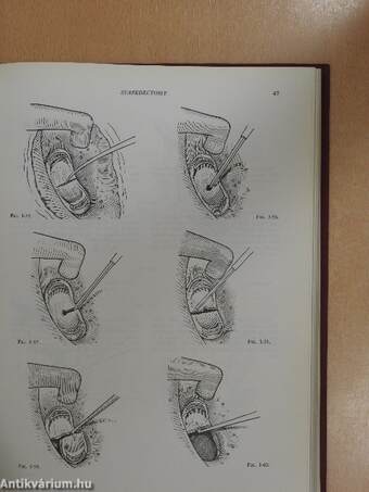 Atlas de techniques chirurgicales de l'oreille/Atlas of Surgical Procedures of the Ear