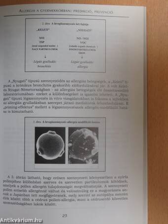 Az allergiás szembetegségek modern megközelítése