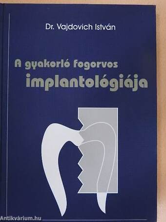 A gyakorló fogorvos implantológiája