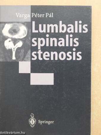 Lumbalis spinalis stenosis