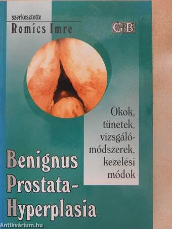 Benignus prostatahyperplasia