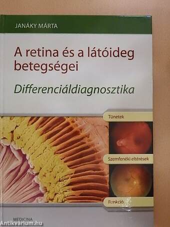 A retina és a látóideg betegségei