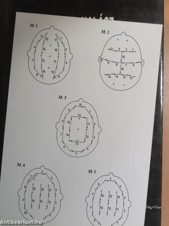 A felnőttkori epilepszia EEG atlasza