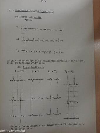 EKG-atlasz