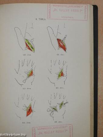 A gyakorló orvos sebészeti műtéttana