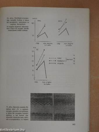 Myocardialis infarctus